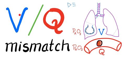 v/q ratio mismatch|v q mismatch medical term.